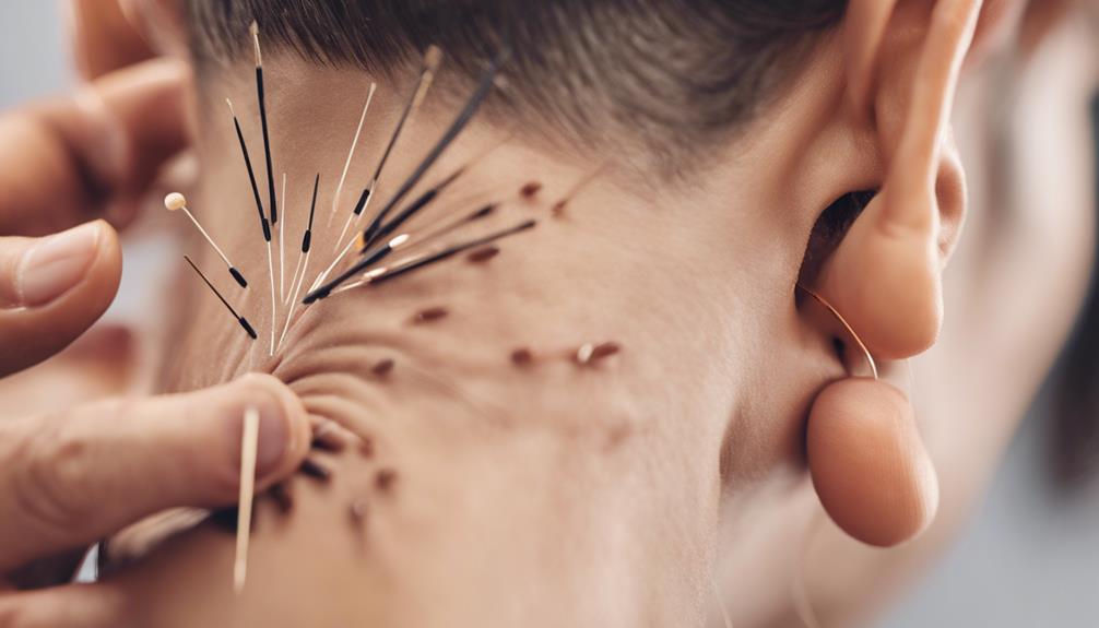 benefits of auricular acupuncture