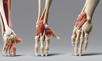 gicht und arthrose vergleichen
