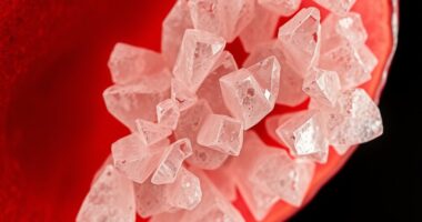 Gicht schädigt die Nieren durch Harnsäure