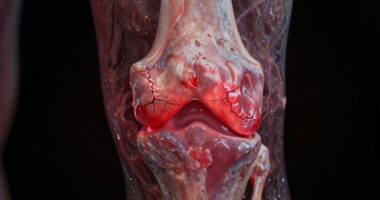 Arthritis und Entzündung Ursachen