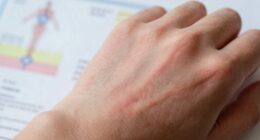 Früherkennung von stiller Entzündung