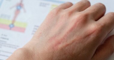 Früherkennung von stiller Entzündung