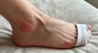 Gicht-Gelenkschutz-Tipps