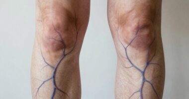 Bein Durchblutung Venen Schwere