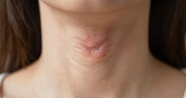 anhaltende Heiserkeit Ursachen