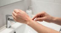 6 Signs Your Skin Needs Medical Attention, Stat