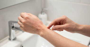 6 Signs Your Skin Needs Medical Attention, Stat