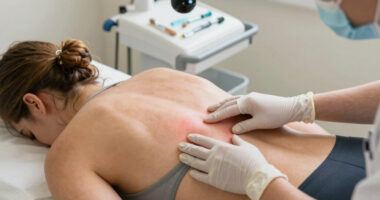 7 Common Misdiagnoses for Hidradenitis Suppurativa (HS)