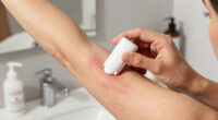 Deodorant Armpit Rash: Causes, Prevention, and Treatment